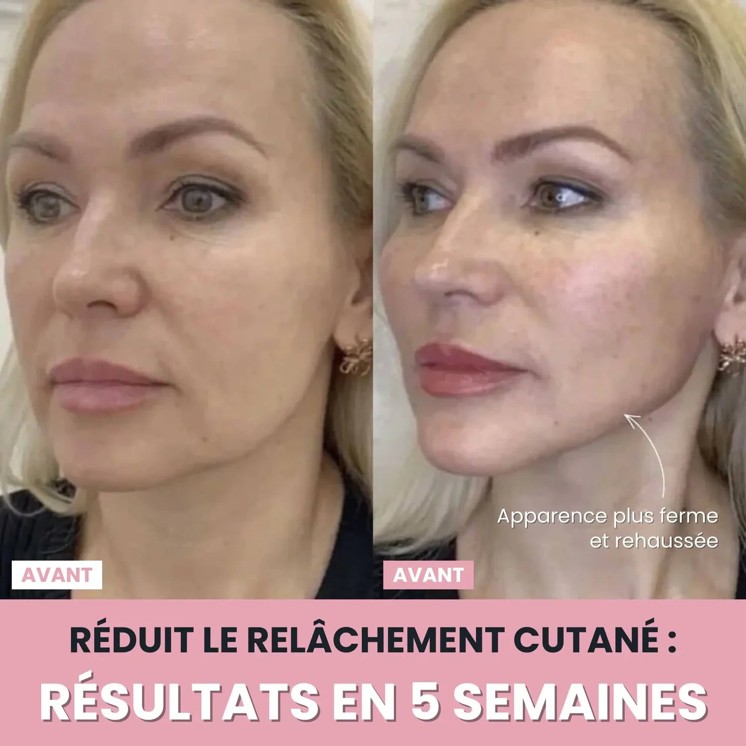 Sculpteur facial LUNEYA