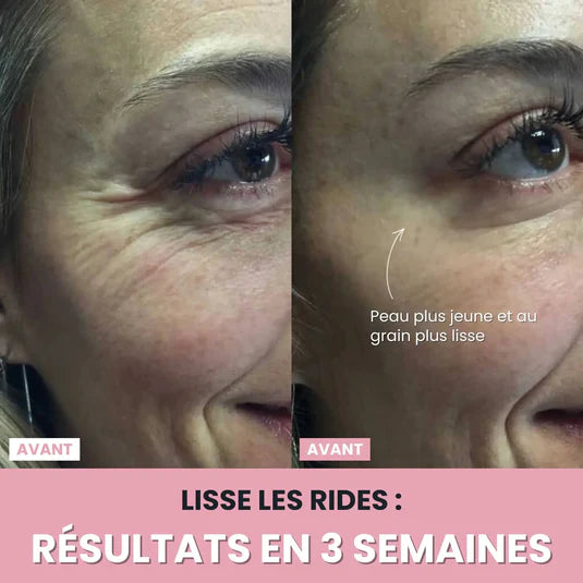 Sculpteur facial LUNEYA