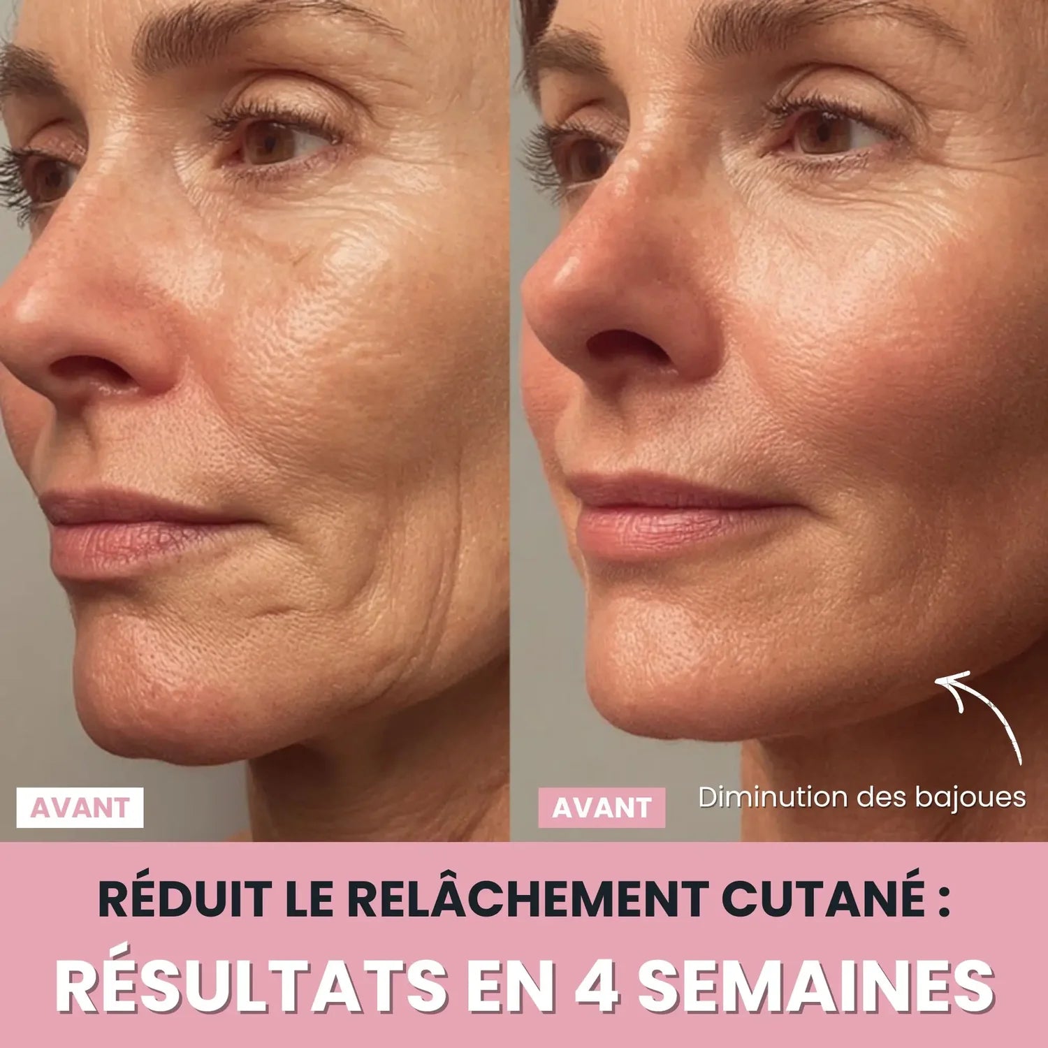 Sculpteur facial LUNEYA