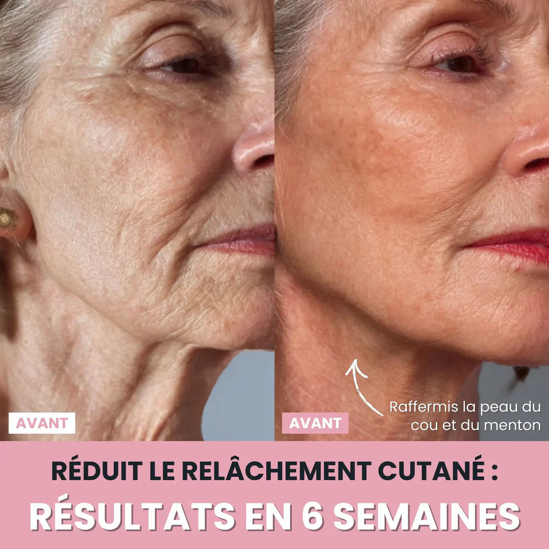 Sculpteur facial LUNEYA
