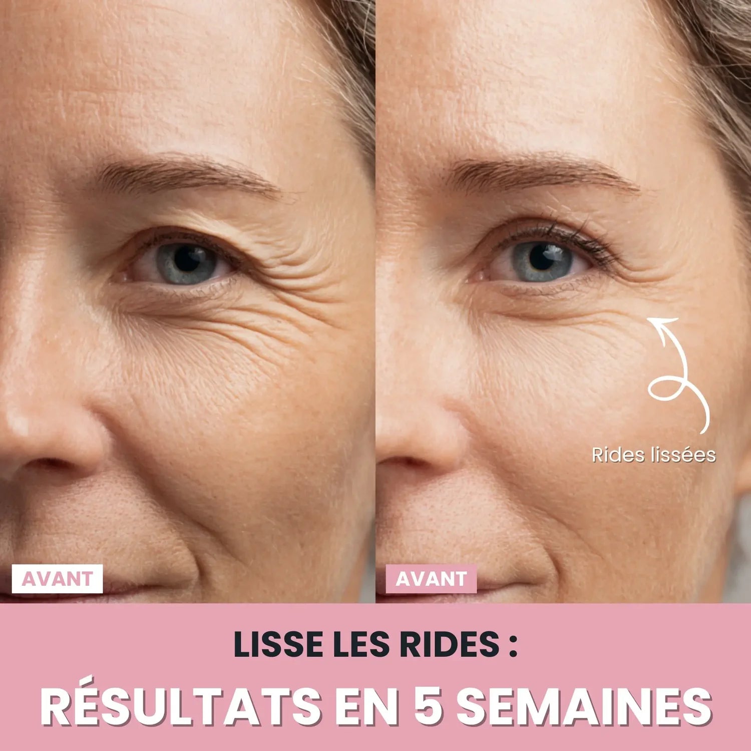 Sculpteur facial LUNEYA