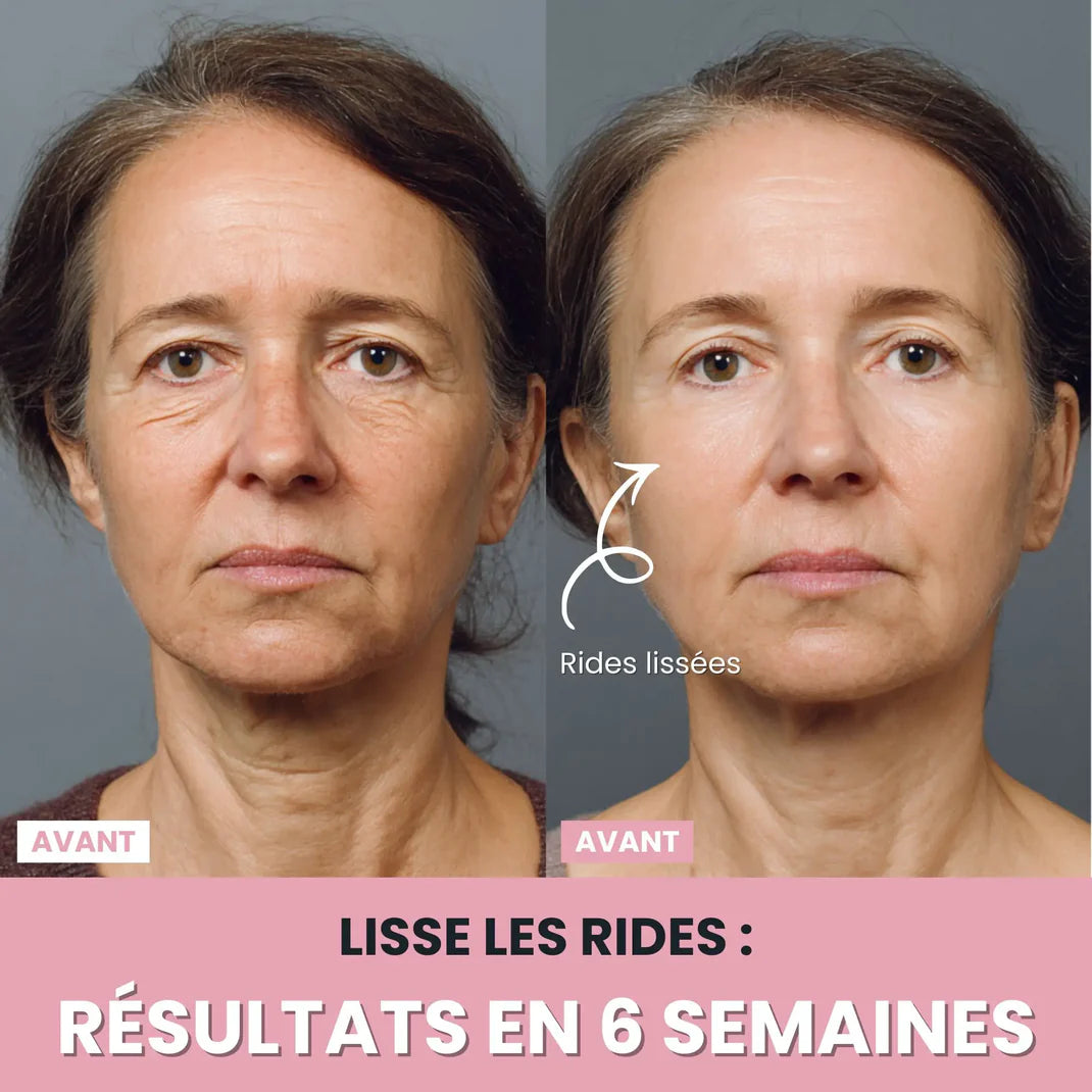 Sculpteur facial LUNEYA
